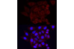 Immunofluorescence analysis of HeLa using Vinculin Rabbit mAb (ABIN3016604, ABIN3016605, ABIN1680530 and ABIN1680531) at dilution of 1:100 (40x lens). (Vinculin 抗体)