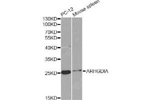 Western blot analysis of extracts of various cell lines, using ARHGDIA antibody (ABIN6291256) at 1:1000 dilution. (ARHGDIA 抗体)