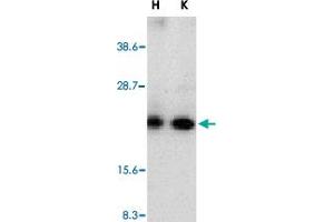 Western blot analysis of CRADD in whole cell lysates from HeLa (H) or K-562 (K) cells with CRADD polyclonal antibody  at 1 : 500 dilution. (CRADD 抗体  (AA 99-117))