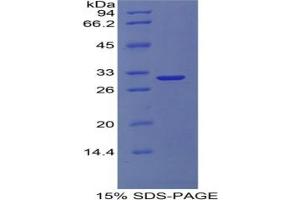 SDS-PAGE analysis of Human COL4A1 Protein. (COL4A1 蛋白)