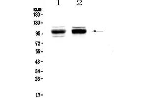 Western blot analysis of SATB1 using anti-SATB1 antibody . (SATB1 抗体  (AA 638-763))