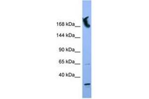 Image no. 1 for anti-Nucleoporin 155kDa (NUP155) (N-Term) antibody (ABIN6746368) (NUP155 抗体  (N-Term))