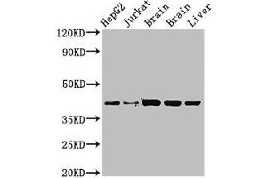 Western Blot Positive WB detected in: HepG2 whole cell lysat, Jurkat whole cell lysate, Rat brain tissue, Mouse brain tissue, Mouse liver tissue All lanes: IDH3A antibody at 3. (IDH3A 抗体  (AA 28-108))