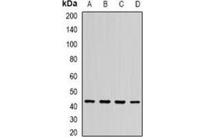 Western blot analysis of ST3GAL5 expression in BT474 (A), SHSY5Y (B), mouse brain (C), rat brain (D) whole cell lysates. (ST3GAL5 抗体)