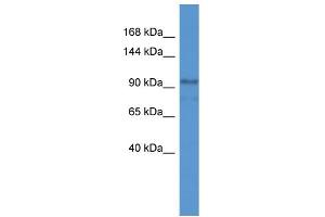 WB Suggested Anti-NLRP2 Antibody Titration: 0. (NLRP2 抗体  (C-Term))
