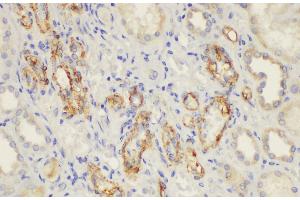Immunohistochemistry of paraffin-embedded Human kidney using CD146 Ployclonal Antibody at dilution of 1:50. (MCAM 抗体)