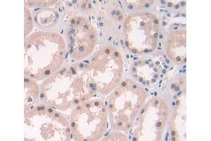 Used in DAB staining on fromalin fixed paraffin- embedded Kidney tissue (ERCC2 抗体  (AA 404-637))