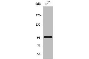 Western Blot analysis of HepG2 cells using Plakophilin 2 Polyclonal Antibody (Plakophilin 2 抗体  (C-Term))