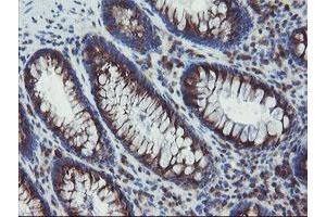Immunohistochemical staining of paraffin-embedded Human colon tissue using anti-ACBD3 mouse monoclonal antibody. (ACBD3 抗体)