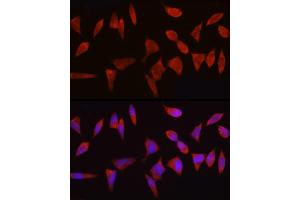 Immunofluorescence (IF) image for anti-B-Cell CLL/lymphoma 2 (BCL2) antibody (ABIN7265809)