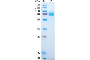 Human Protein, hFc Tag on SDS-PAGE under reducing condition.