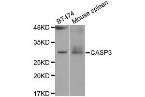 Western blot analysis of extracts of various cell lines, using CASP3 antibody (ABIN5997364) at 1/1000 dilution. (Caspase 3 抗体)
