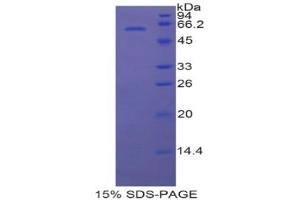 SDS-PAGE analysis of Rat HSD17b12 Protein. (HSD17B12 蛋白)