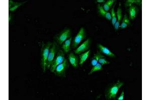 Immunofluorescent analysis of Hela cells using ABIN7145493 at dilution of 1:100 and Alexa Fluor 488-congugated AffiniPure Goat Anti-Rabbit IgG(H+L) (GLB1 抗体  (AA 317-455))