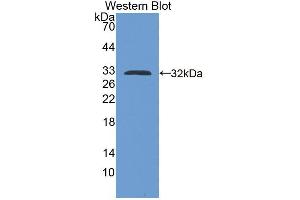 Western blot analysis of the recombinant protein. (Kallikrein 13 抗体  (AA 22-277))