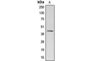 Western blot analysis of Kappa-actin expression in HuvEc (A) whole cell lysates. (ACTBL3 抗体  (Center))