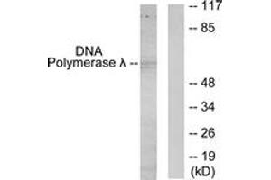 Western blot analysis of extracts from 293 cells, using DNA Polymerase lambda Antibody. (POLL 抗体  (AA 451-500))