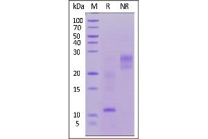 Biotinylated Human TSLP, His,Avitag on  under reducing (R) and ing (NR) conditions. (Thymic Stromal Lymphopoietin Protein (TSLP) (AA 29-159) (His tag,AVI tag,Biotin))