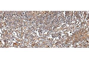 Immunohistochemistry of paraffin-embedded Human tonsil using VSIG8 Polyclonal Antibody at dilution of 1/30 (VSIG8 抗体)