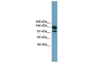 WB Suggested Anti-LRRC66 Antibody Titration:  0. (LRRC66 抗体  (Middle Region))