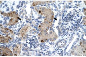 Immunohistochemistry (IHC) image for anti-Zinc Finger, MYM-Type 6 (ZMYM6) (Middle Region) antibody (ABIN2776049)