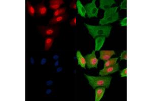 Phospho-Foxp3 (Ser19) Antibody staining A549 cells(H2O2 treatment) by IF/ICC. (FOXP3 抗体  (pSer19))