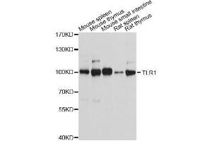 Western blot analysis of extracts of various cell lines, using TLR1 antibody. (TLR1 抗体  (AA 30-290))