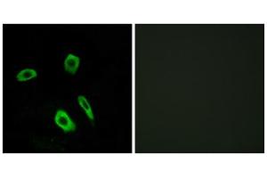 Immunofluorescence analysis of LOVO cells, using EDG7 antibody. (LPAR3 抗体  (Internal Region))