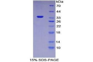 SDS-PAGE analysis of Mouse MRC1 Protein. (Macrophage Mannose Receptor 1 蛋白)