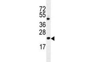 Bax antibody western blot analysis in HL-60 lysate (BAX 抗体  (AA 41-76))