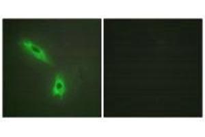 Immunofluorescence analysis of HeLa cells, using TNFC antibody. (LTB 抗体  (C-Term))