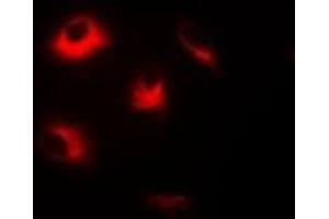 Immunofluorescent analysis of Dopamine Receptor D5 staining in Hela cells. (DRD5 抗体)
