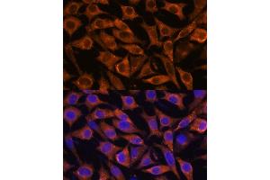 Immunofluorescence (IF) image for anti-Interferon-Induced Transmembrane Protein 3 (IFITM3) (AA 1-133) antibody (ABIN6142186)