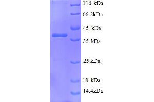 SDS-PAGE (SDS) image for Nephronophthisis 1 (Juvenile) (NPHP1) (AA 1-109), (partial) protein (GST tag) (ABIN5710019)