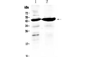 Western blot analysis of TFPI using anti- TFPI antibody . (TFPI 抗体  (AA 253-304))
