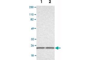 Western Blot analysis of Lane 1: RT-4 and Lane 2: U-251MG sp cell lysates with RAB13 polyclonal antibody . (RAB13 抗体)