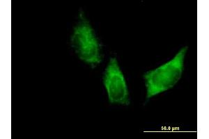 Immunofluorescence of purified MaxPab antibody to DARS on HeLa cell. (DARS 抗体  (AA 1-501))