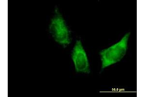 Immunofluorescence of purified MaxPab antibody to DARS on HeLa cell.
