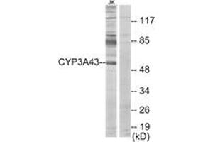 Western Blotting (WB) image for anti-Cytochrome P450, Family 3, Subfamily A, Polypeptide 4 (CYP3A4) (AA 231-280) antibody (ABIN2889951) (CYP3A4 抗体  (AA 231-280))
