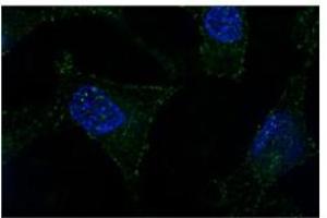 Sample Type: subnuclear bodies-paraspeckles (NONO 抗体  (N-Term))