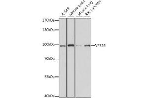 Western blot analysis of extracts of various cell lines, using VPS16 antibody (ABIN7271281) at 1:1000 dilution. (VPS16 抗体  (AA 540-839))