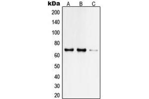 Western Blotting (WB) image for anti-TAF6-Like RNA Polymerase II, P300/CBP-Associated Factor (PCAF)-Associated Factor, 65kDa (TAF6L) (N-Term) antibody (ABIN7297814)