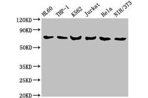 Western Blot Positive WB detected in: HL60 whole cell lysate, THP-1 whole cell lysate, K562 whole cell lysate, Jurkat whole cell lysate, Hela whole cell lysate, NIH/3T3 whole cell lysate All lanes: LCP1 antibody at 8 μg/mL Secondary Goat polyclonal to rabbit IgG at 1/10000 dilution Predicted band size: 71, 22 kDa Observed band size: 71 kDa (LCP1 抗体  (AA 2-627))