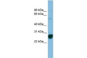 WB Suggested Anti-RPL10A Antibody Titration: 0. (RPL10A 抗体  (N-Term))
