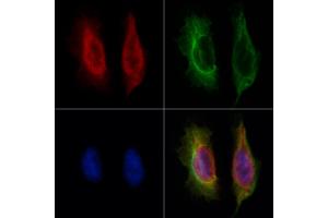 ABIN6265329 and ABIN6273169 staining Hela by IF/ICC. (STAU1/Staufen 抗体  (Internal Region))