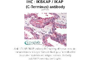 Image no. 2 for anti-Elongator Complex Protein 1 (ELP1) antibody (ABIN1735852) (IKAP/p150 抗体)