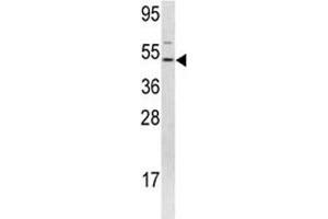 Western blot analysis of FLI1 antibody and 293 lysate. (FLI1 抗体  (AA 52-80))