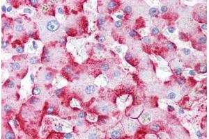 Human Liver (formalin-fixed, paraffin-embedded) stained with C4BPA antibody ABIN334259 at 5 ug/ml followed by biotinylated anti-mouse IgG secondary antibody ABIN481714, alkaline phosphatase-streptavidin and chromogen. (C4BP 抗体)