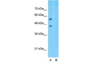 Host:  Rabbit  Target Name:  SLC15A4  Sample Type:  293T  Lane A:  Primary Antibody  Lane B:  Primary Antibody + Blocking Peptide  Primary Antibody Concentration:  1ug/ml  Peptide Concentration:  5ug/ml  Lysate Quantity:  25ug/lane/lane  Gel Concentration:  0. (SLC15A4 抗体  (Middle Region))