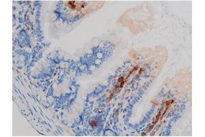 ABIN6267438 at 1/200 staining Mouse intestinal tissue sections by IHC-P. (RPS6KB1 抗体  (pSer371))